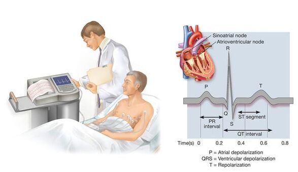Elektrocardiografie fir kardiovaskulär Krankheeten mat Hypertonie z'entdecken